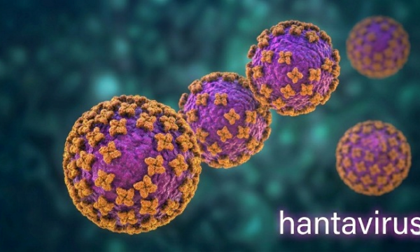HANTAVIRUS  .